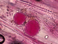 Figure 35. Chlamydospores of Phytophthora nicotianae in root tissue.