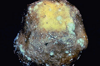 图10. 马铃薯块茎上致病疫霉(Phytophthora infestans)的孢子形成(白色区域)。 (H. D. Thurston提供)