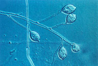 Figura 15. Esporângio em um esporangioforo de Phytophthora infestans. (Cortesia W. E. Fry)