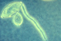 图17. 正在萌发的孢子囊。(H. D. Thurston 提供)