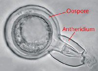 Figura 19. Oosporo com anterídio. (Cortesia Plant Pathology Section, West Virginia University)