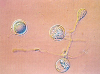 Figura 22. Oosporo germinando e produzindo um esporângio. (Cortesia W. E. Fry)