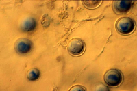 Figure 14. Oospores of Phytophthora capsici in a culture plate. (Courtesy M. Babadoost)