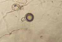 Figure 6a. Phytophthora sojae oospore with amphigynous antheridium (oogonial stalk is surrounded by the antheridium) (Courtesy K. Broders). 