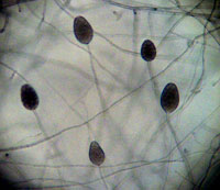 Figure 7. Phytophthora sojae sporangia (Courtesy K. Broders). 