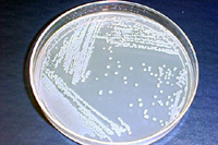 Figure 21. Round, cream-colored, colonies of Acidovorax avenae subsp. citrulli after 48 hr of growth on King’s medium B at 28°C.
