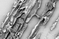 Microfotografia eletrônica de varredura indicando células de Acidovorax avenae subsp. citrulli no apoplasto 