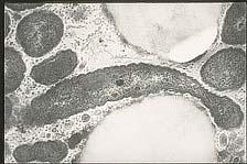 Figure 19b. Close-up of a bacterial cell in the bordered pit of a vessel element. (Courtesy J.R. Hartman) (Courtesy J.R. Hartman