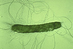 Figure 9. Electron micrograph of an Erwinia cell showing peritrichous flagella. (Courtesy Oregon State University)