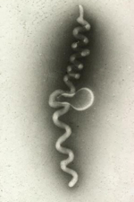 Figure 2. Electron micrograph of spiroplasmas. (Courtesy R.E. Davis)