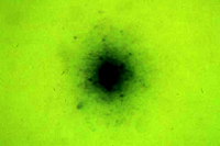 Figure 9. Spiroplasma colonies grown on agar. Note satellite colonies. (Courtesy J. Fletcher) 
