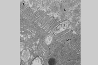 Figure 12. Spiroplasma citri entering leafhopper gut epithelium. (Courtesy M. Kwon, A. Wayadande, and J. Fletcher)