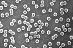 Figure 8. Electron micrograph of purified BYD virions (ca. 25 nm in diameter). (Courtesy C.J. D’Arcy and L.L. Domier)