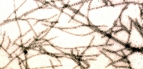 Figura 3. Micrografia electrónica de particulas do PRSV (tingido negativamente). (Cortesia de D. Gonsalves, copyright-free)