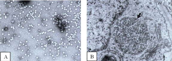 Electron micrographs of particles of Papaya lethal yellowing virus (PLYV)